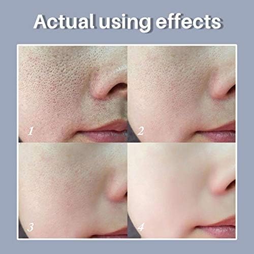 Serum dropper with pore solution formula