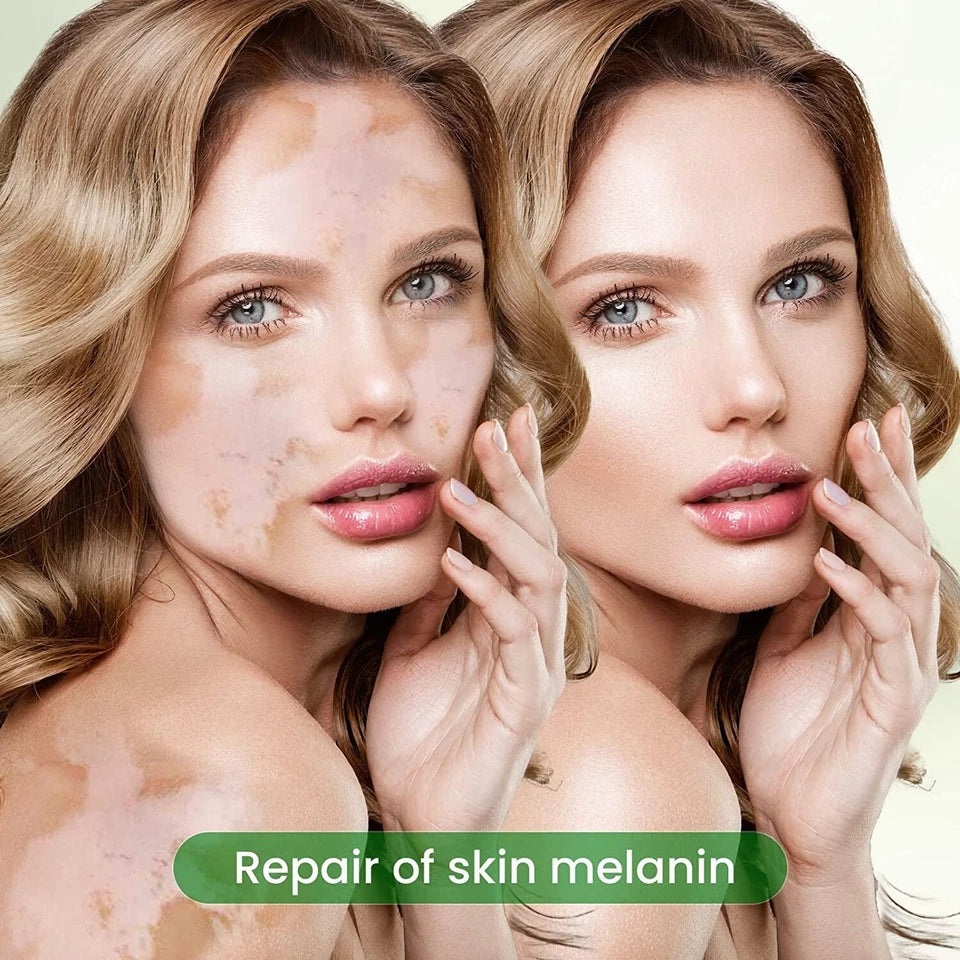 Sumifun vitamin E cream being applied to skin